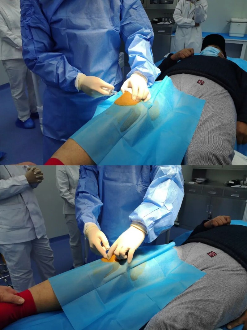 喜报首例?脐带间充质干细胞注射液治疗膝关节骨性关节炎细胞治疗技术成功落地乐杰 图3